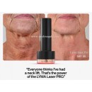 Lyma Laser Pro - Sale